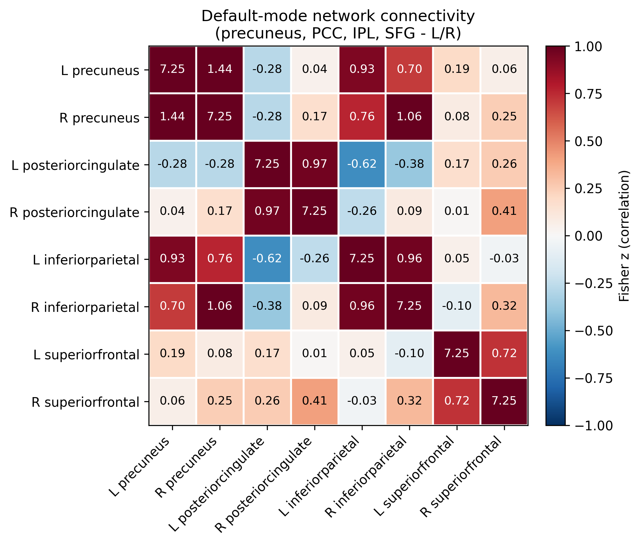 Default-mode network connectivity matrix